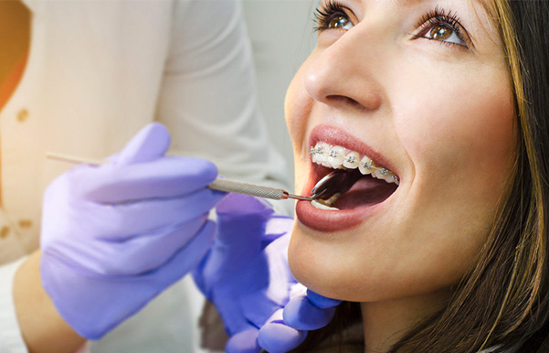 Ортодонтическое лечение и уход за брекетами